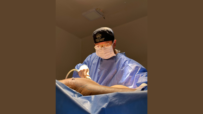 Milton Seigi Hayashi revela como o enxerto de gordura pode remodelar o corpo com naturalidade e segurança.